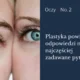 plastyka powiek co chcesz wiedzieć