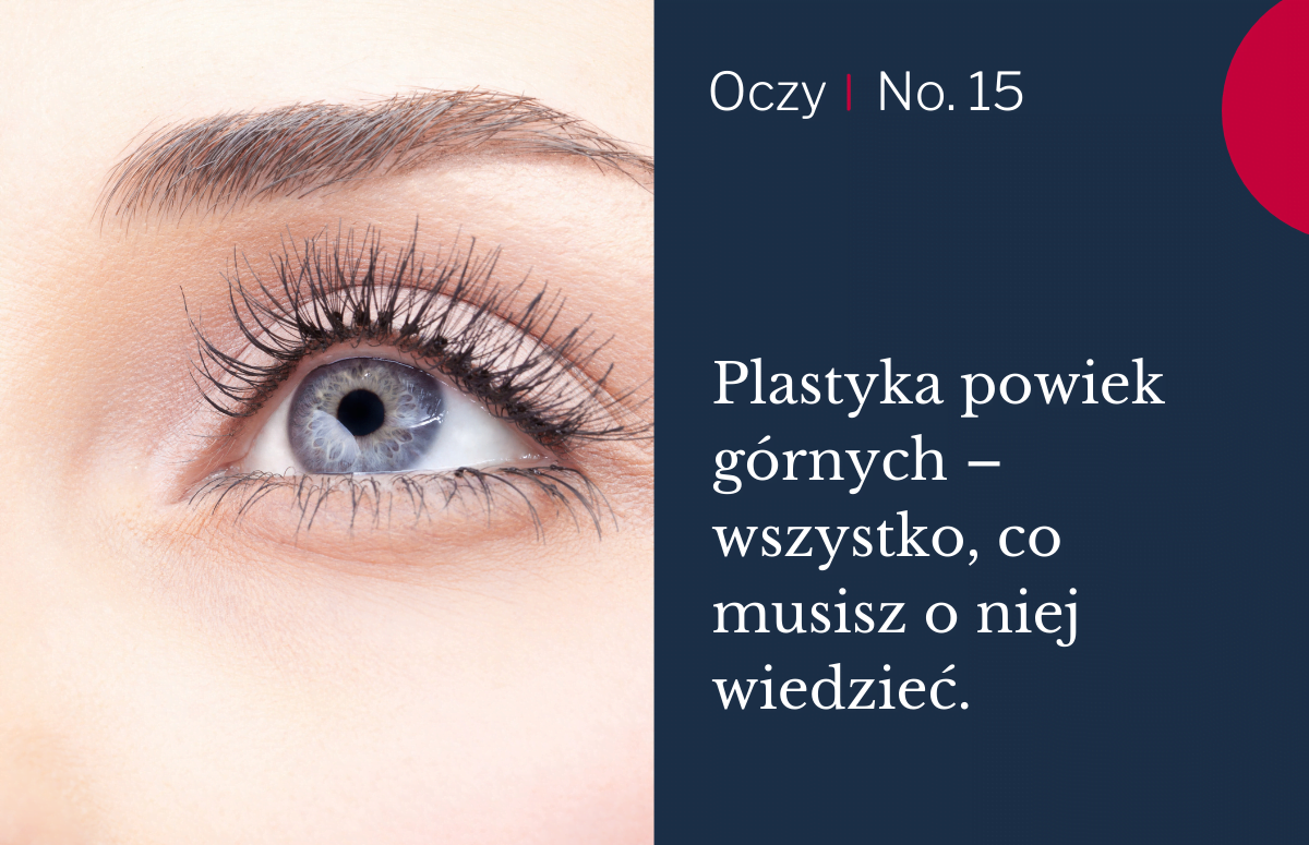 plastyka powiek co musisz wiedzieć