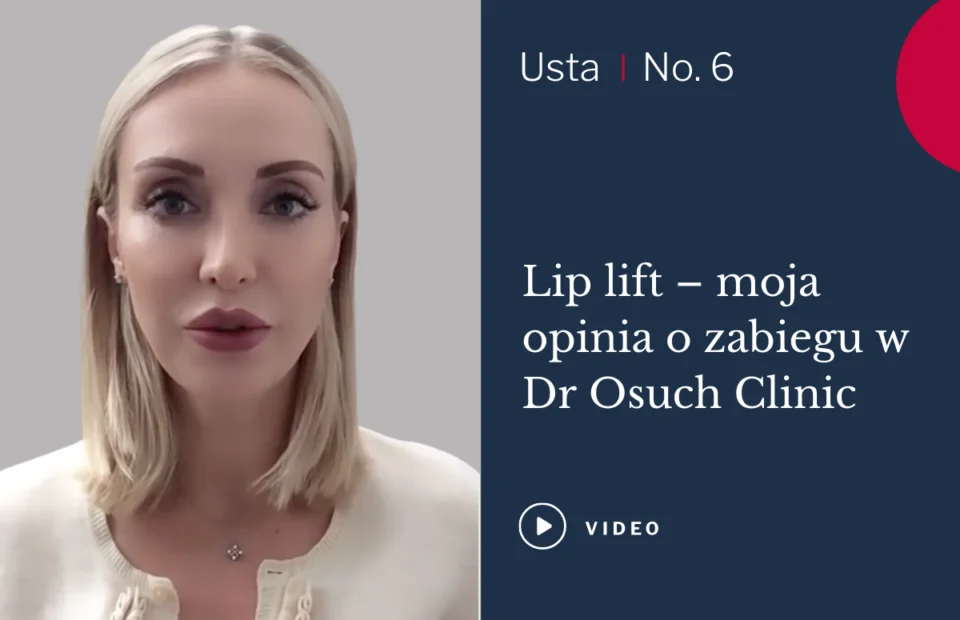 lip lift opinia pacjentki magdy